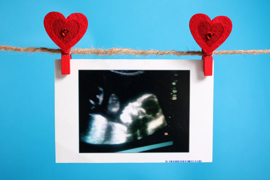 ecografia gravidanza