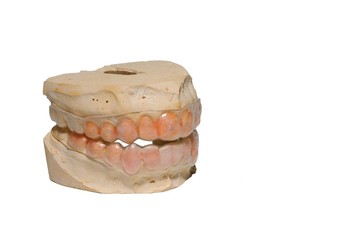 Teeth Cast