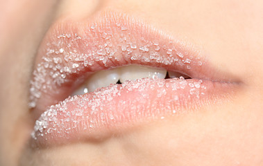 Zucker Lippen