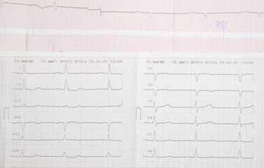 Real cardiological test