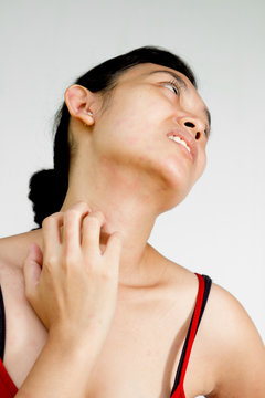 Woman neck and face with skin rash