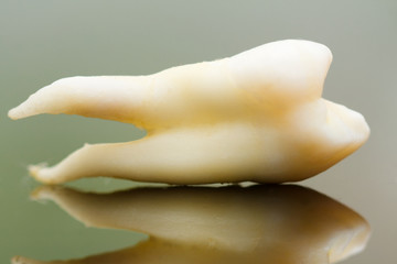 Extracted tooth with strange, curved root