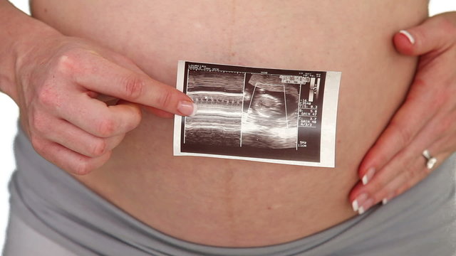 Pregnant woman showing us scan of her futur baby