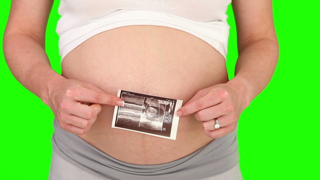 Pregnant woman showing us a scan of her future baby