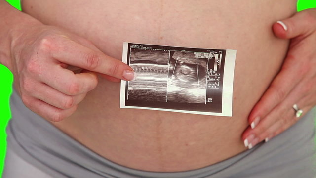 A scan of a future baby