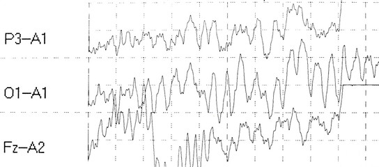 graph brain wave EEG isolated on white background - obrazy, fototapety, plakaty