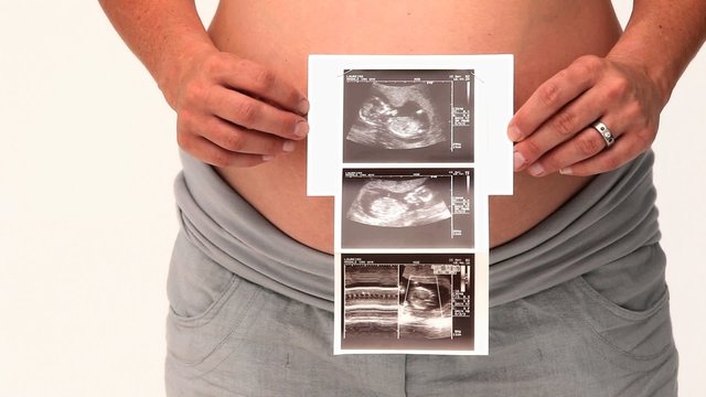 Pregnant woman holding a scan