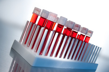 Blood samples
