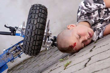 Boy after accident