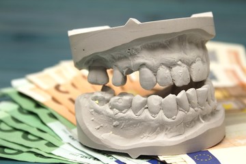 Versorgung mit neuen Zähnen