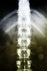 X-ray