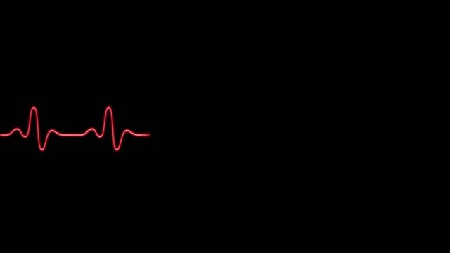 EKG