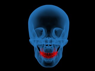 dental X ray.jpg