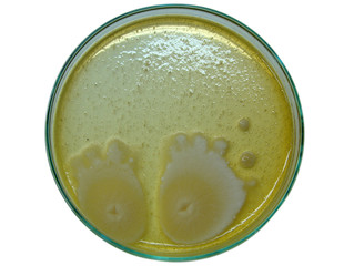 Microbiology specimen