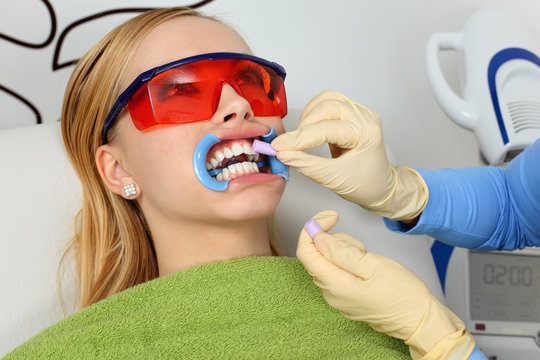 During the process of teeth whitening