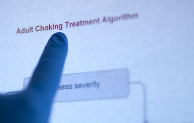 Pointing out the treatment for choking - 30698192