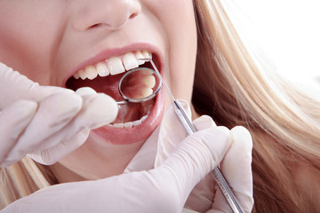 Frau mit weisse Zähne bei Untersuchung Nahaufnahme