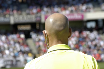 Hombre con calva 2