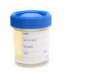 urine sample