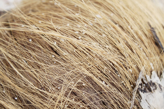 hairy coconut