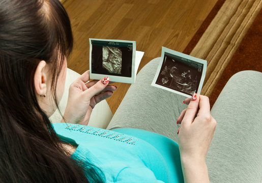 Pregnant woman with ultrasound pictures of her baby
