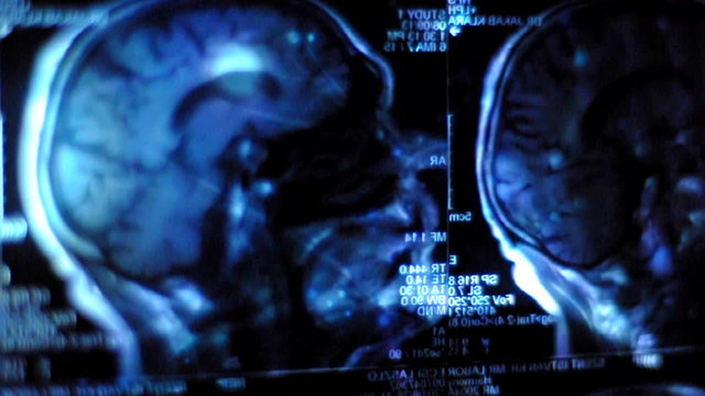 Closeup of a CT scan with flourish