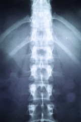 X-ray