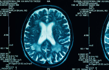sharp ct scan of the human brain