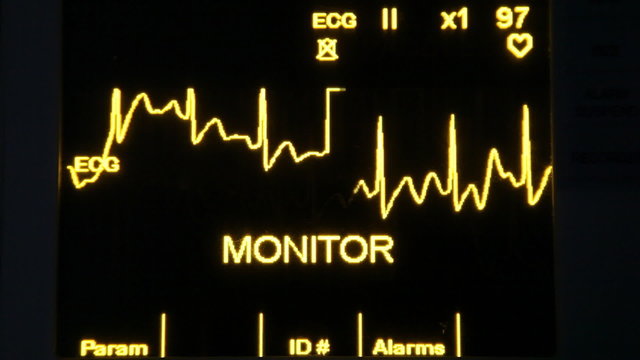 actual EKG monitor
