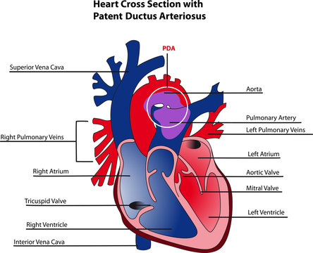 Ductus arteriosus