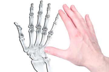 Hand in flash and bone