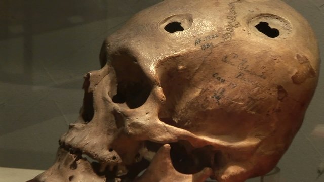 Sch&auml;deloperation, Peru