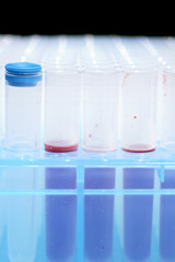 medical test tubes