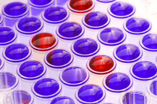 Makro einer Mikrotiterplatte f&uuml;r medizinische Diagnostik