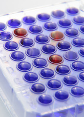 Positive reacting samples in medical test in microtiter plate