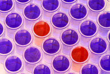 Positive and negative laboratory tests