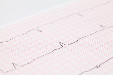 Close-up view on cardiogram