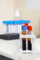 Test tubes with blood