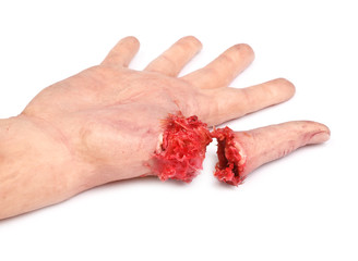 artificial human hand with cut out finger - 32204546