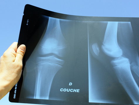 radiologie articulation genou
