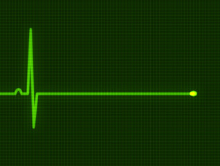 cardiogram