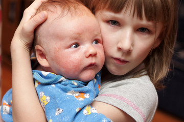 Girl pitied her brother