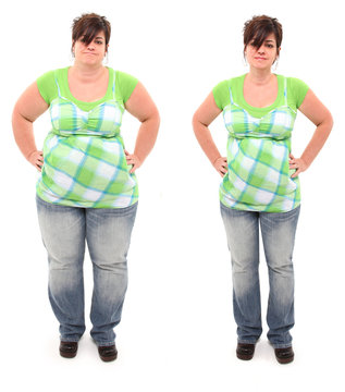 Before And After Overweight 45 Year Old Woman