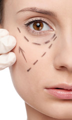 Correction lines on woman face, before surgery operetion