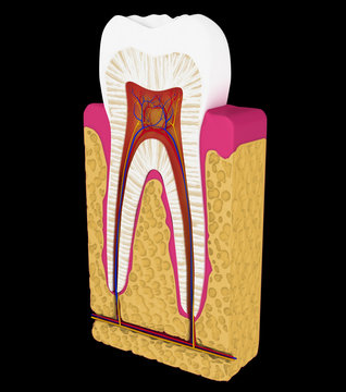 Dentistry: Tooth cut or section