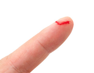 Bleeding from the cut finger