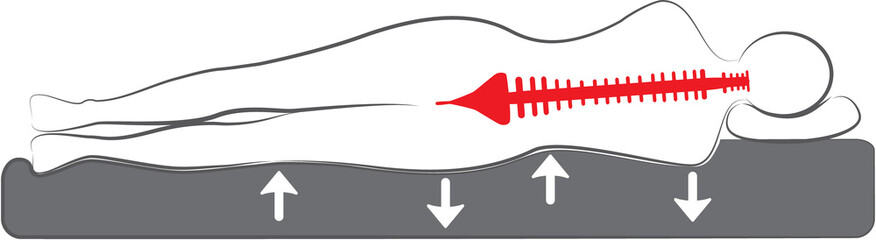 schematic drawing of the orthopedic bed or mattress