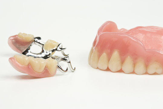 Gegenüberstellung Zahnprothesen