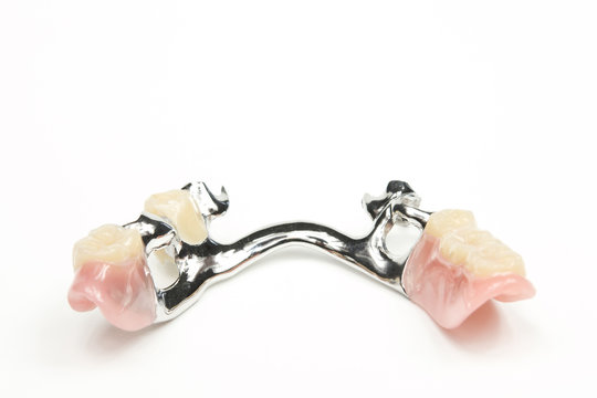 Unterkiefer Teilprothese Zahnersatz