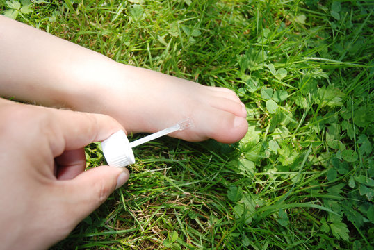 Kinderfuss und Warzenbehandlung